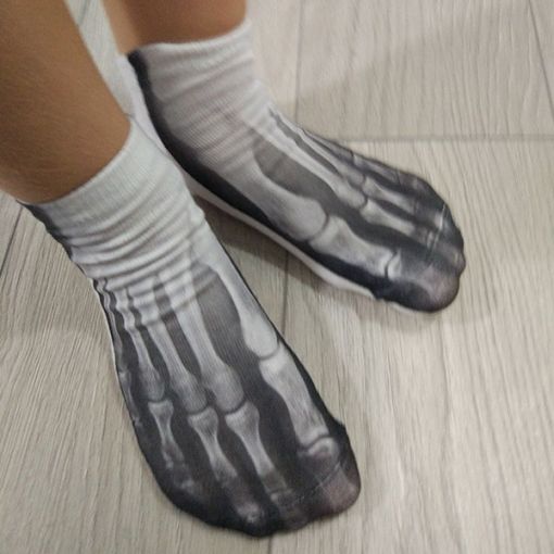 Rendgenske Čarape